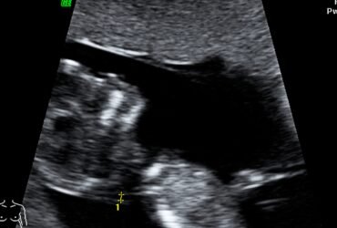 Yellow and Black Modern How To Make YouTube Thumbnail (17)